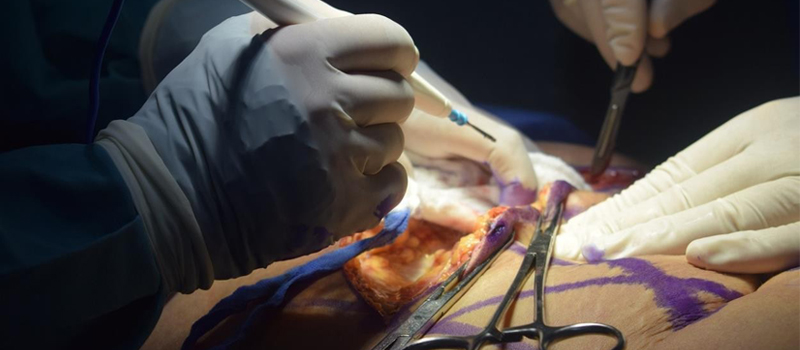 6 Methods Plastic Surgical procedure Helps Folks